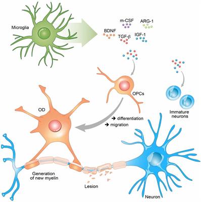 Beneficial Roles of Microglia and Growth Factors in MS, a Brief Review